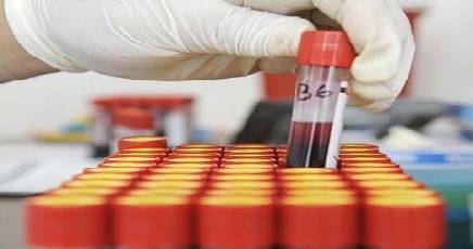Aids, il virus continua a diffondersi in Puglia: 160 nuovi casi nel 2016
