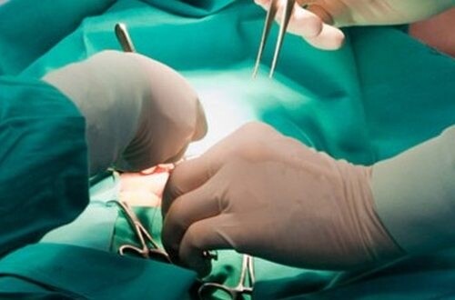 Bari, 50enne morta per emorragia dopo un intervento: condannato un cardiologo