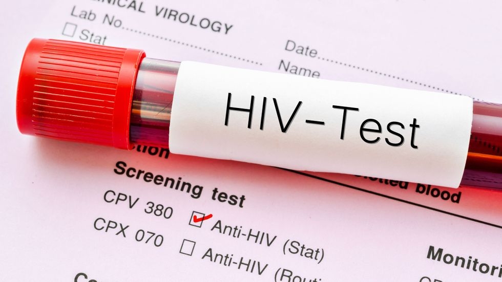 Bari, a Torre Quetta e sul lungomare San Giorgio test e screening HIV gratuiti