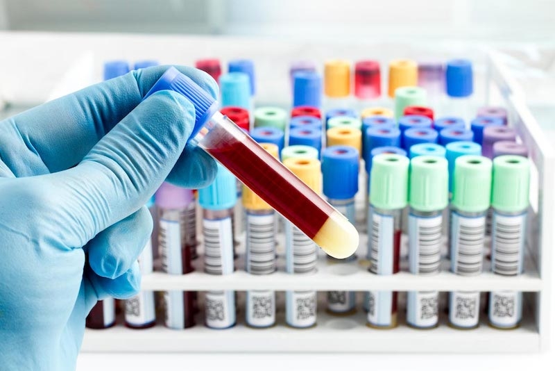 Bari, analisi sulla paziente cinese: ‘Nessun caso di Coronavirus’