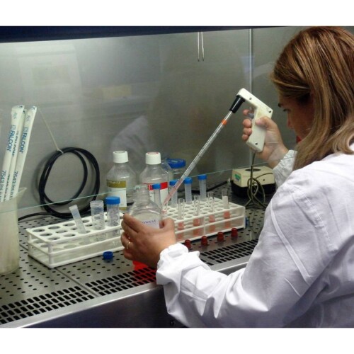 Bari, team di ricercatori scopre un nuovo gene coinvolto nella Leucemia acuta mieloide