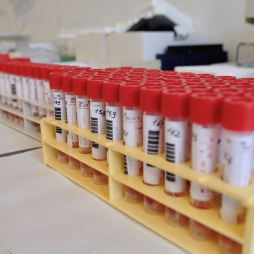 Covid, sono 4.366 i nuovi contagi in Puglia: registrati 11 decessi