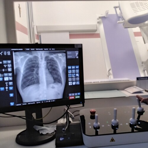 Medicina penitenziaria, un nuovo ambulatorio dedicato alla cura delle patologie neurologiche nel carcere di Bari