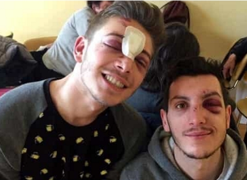 Milano, 24enne bitontino aggredito dal branco all’uscita da un locale gay