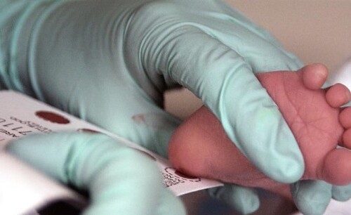 Puglia: da gennaio sarà attivato lo screening neonatale per combattere la Fibrosi Cistica