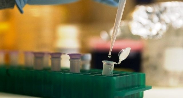 Sanità, in Puglia un nuovo biomarcatore per individuare il tumore al fegato