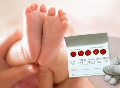 Screening neonatale metabolico allargato: in Puglia si diagnosticano 40 patologie