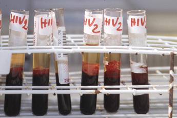 ‘Parliamo di Hiv oggi. Per guardare al domani’, al via la seconda stagione del webinar promosso da Adnkronos