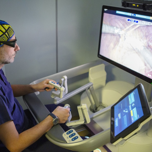 Chirurgia robotica: a Ospedale Santa Maria il 1° intervento in Puglia con robot Hugo per tumore del colon-retto