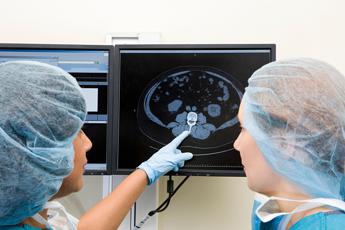 Kinsella e il cancro al cervello, cos’è il glioblastoma che l’ha colpita