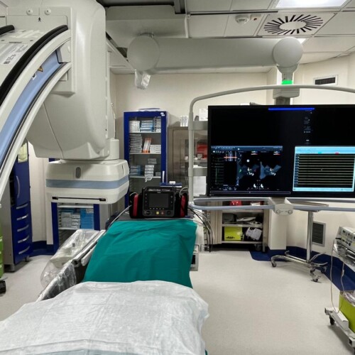 Ospedale Di Venere: avviate le prime procedure di ablazione per le aritmie sopraventricolari