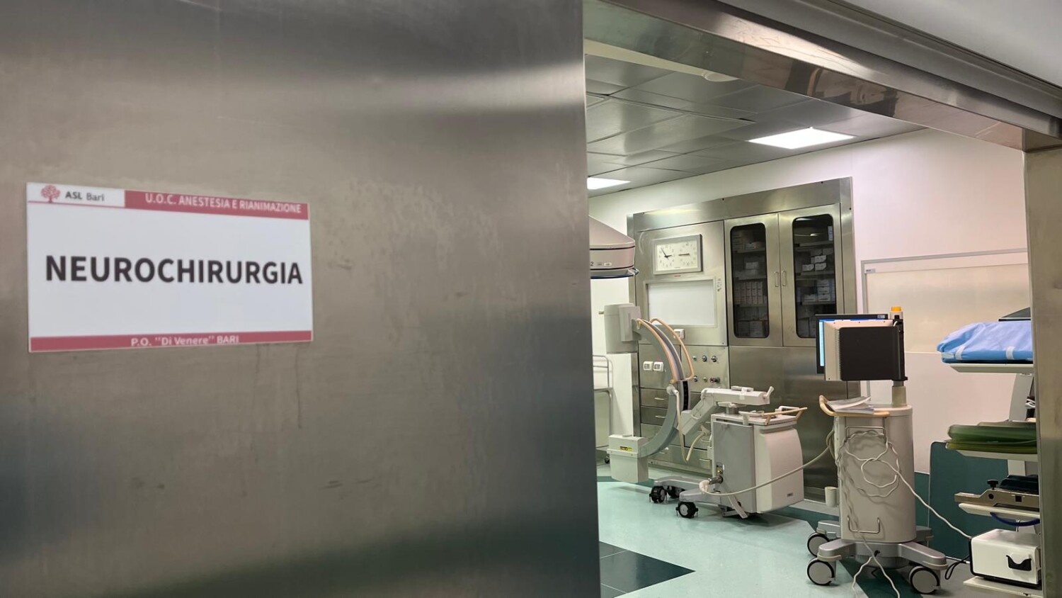 Neurochirurgia al Di Venere, intervento ad alta specializzazione per rimuovere un raro tumore sul nervo mediano dell’avambraccio grande oltre i 3 centimetri