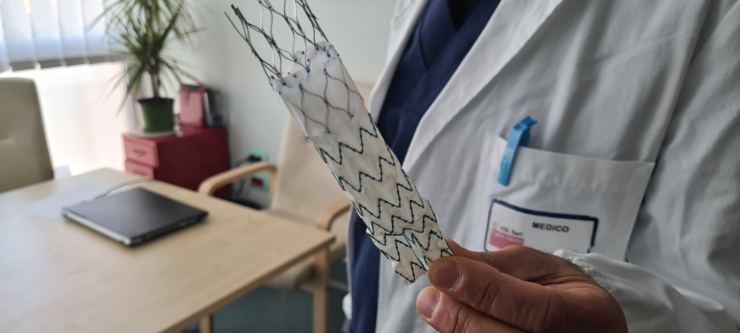 All’Ospedale Di Venere di Bari è stato eseguito con successo il primo intervento di riparazione endovascolare di aneurisma dell’aorta addominale (EVAR) pianificato con il supporto dell’Intelligenza Artificiale e della tecnologia “Digital Twin”