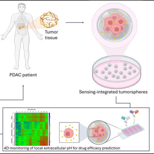 Tumore del pancreas: sensori “intelligenti” nei tessuti misurano la risposta alla chemioterapia